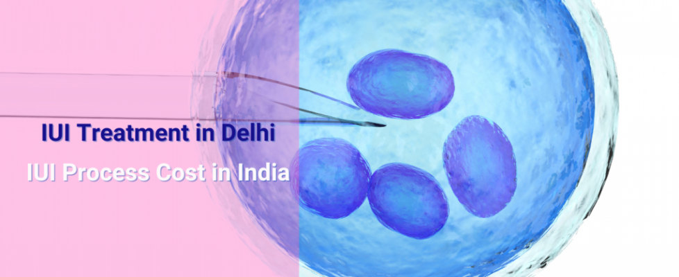 IUI Treatment in Delhi