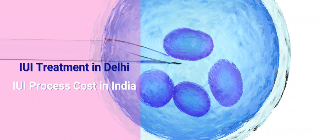 IUI Treatment in Delhi | IUI Process Cost In India